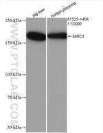 CD206 Antibody in Western Blot (WB)