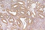 pan-RAS Antibody in Immunohistochemistry (Paraffin) (IHC (P))