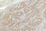 JNK Antibody in Immunohistochemistry (Paraffin) (IHC (P))
