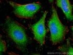 GAPDH Antibody in Immunocytochemistry (ICC/IF)