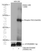 Phospho-TSC2 (Ser939) Antibody in Western Blot (WB)