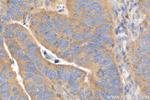 mTOR Antibody in Immunohistochemistry (Paraffin) (IHC (P))