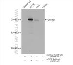 mTOR Antibody in Immunoprecipitation (IP)