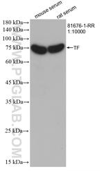 Transferrin Antibody in Western Blot (WB)