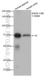 Transferrin Antibody in Western Blot (WB)