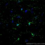 IBA1 Antibody in Immunohistochemistry (PFA fixed) (IHC (PFA))
