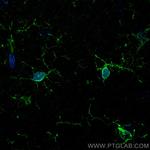 IBA1 Antibody in Immunohistochemistry (PFA fixed) (IHC (PFA))
