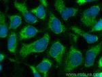 TGF Beta 1 Antibody in Immunocytochemistry (ICC/IF)