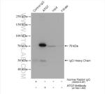 ATG7 Antibody in Immunoprecipitation (IP)