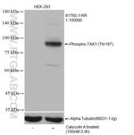 Phospho-TAK1 (Thr187) Antibody in Western Blot (WB)