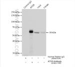 ATG5 Antibody in Immunoprecipitation (IP)