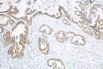 IGF2BP3 Antibody in Immunohistochemistry (Paraffin) (IHC (P))