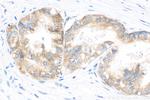 IGF2BP3 Antibody in Immunohistochemistry (Paraffin) (IHC (P))