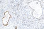 IGF2BP3 Antibody in Immunohistochemistry (Paraffin) (IHC (P))