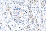 IGF2BP3 Antibody in Immunohistochemistry (Paraffin) (IHC (P))