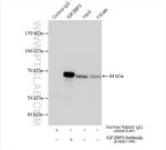 IGF2BP3 Antibody in Immunoprecipitation (IP)