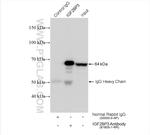 IGF2BP3 Antibody in Immunoprecipitation (IP)