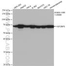 IGF2BP3 Antibody in Western Blot (WB)