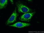 PRDX3 Antibody in Immunocytochemistry (ICC/IF)