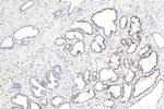 Androgen Receptor Antibody in Immunohistochemistry (Paraffin) (IHC (P))