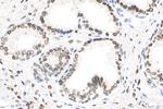 Androgen Receptor Antibody in Immunohistochemistry (Paraffin) (IHC (P))
