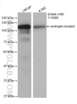 Androgen Receptor Antibody in Western Blot (WB)