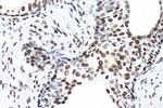 Phospho-CREB1 (Ser133) Antibody in Immunohistochemistry (Paraffin) (IHC (P))