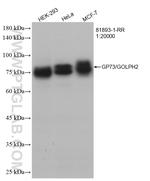 GP73/GOLPH2 Antibody in Western Blot (WB)