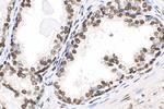 B23/NPM1 Antibody in Immunohistochemistry (Paraffin) (IHC (P))