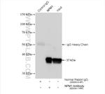 B23/NPM1 Antibody in Immunoprecipitation (IP)