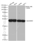 B23/NPM1 Antibody in Western Blot (WB)