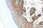 GSK3B Antibody in Immunohistochemistry (Paraffin) (IHC (P))