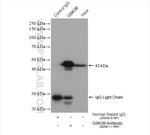 GSK3B Antibody in Immunoprecipitation (IP)