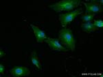 SLC7A11/xCT Antibody in Immunocytochemistry (ICC/IF)