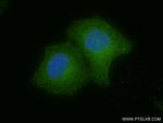 SLC7A11/xCT Antibody in Immunocytochemistry (ICC/IF)