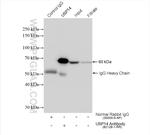USP14 Antibody in Immunoprecipitation (IP)