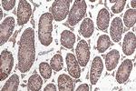 DHX15 Antibody in Immunohistochemistry (Paraffin) (IHC (P))