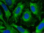 Caspase 3 Antibody in Immunocytochemistry (ICC/IF)