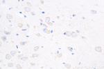 Caspase 3 Antibody in Immunohistochemistry (Paraffin) (IHC (P))