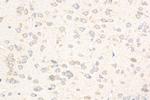 Caspase 3 Antibody in Immunohistochemistry (Paraffin) (IHC (P))