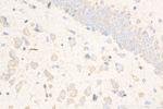 Caspase 3 Antibody in Immunohistochemistry (Paraffin) (IHC (P))