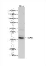 SNAI1 Antibody in Western Blot (WB)