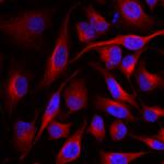 SIRT5 Antibody in Immunocytochemistry (ICC/IF)