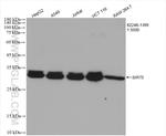 SIRT5 Antibody in Western Blot (WB)