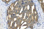 FIS1 Antibody in Immunohistochemistry (Paraffin) (IHC (P))