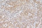 HNRNPL Antibody in Immunohistochemistry (Paraffin) (IHC (P))