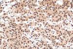 HNRNPL Antibody in Immunohistochemistry (Paraffin) (IHC (P))