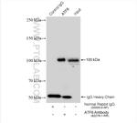 ATF6 Antibody in Immunoprecipitation (IP)