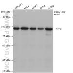 ATF6 Antibody in Western Blot (WB)