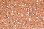 ATP5A1 Antibody in Immunohistochemistry (Paraffin) (IHC (P))